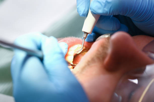 Best Emergency Tooth Extraction  in Lexington, MI