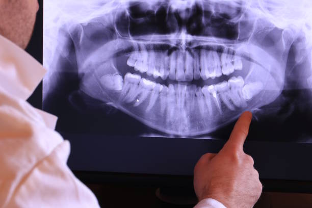 Best Urgent Tooth Repair  in Lexington, MI