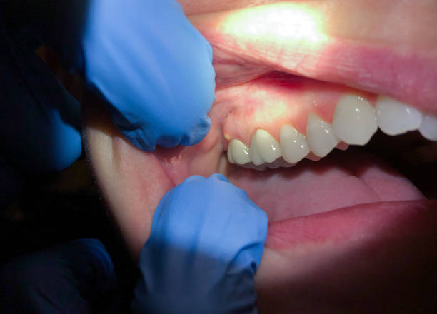 Best Teeth Whitening  in Lexington, MI